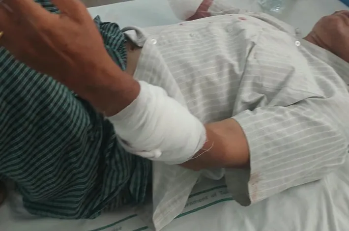 నిర్మల్‌లో కోతుల బీభత్సం.. వ్యక్తిపై దాడి