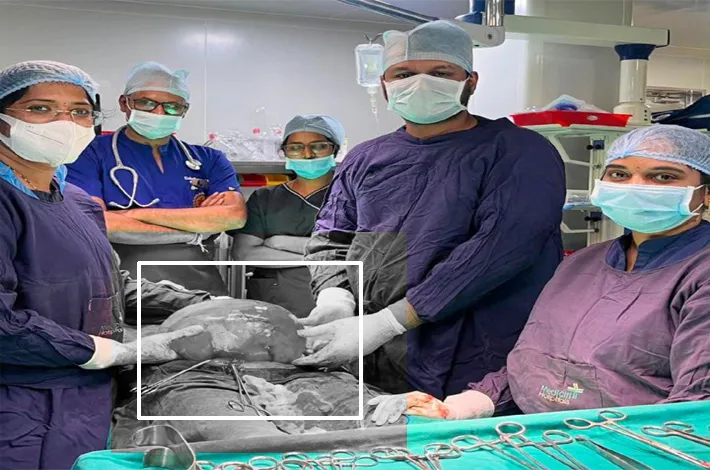 మేడ్చల్ మెడినోవా సూపర్ స్పెషాలిటీ ఆసుపత్రిలో అరుదైన శస్త్ర చికిత్స