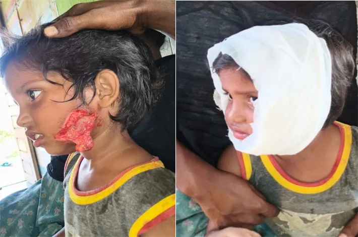 పిచ్చికుక్కల స్వైర విహారం